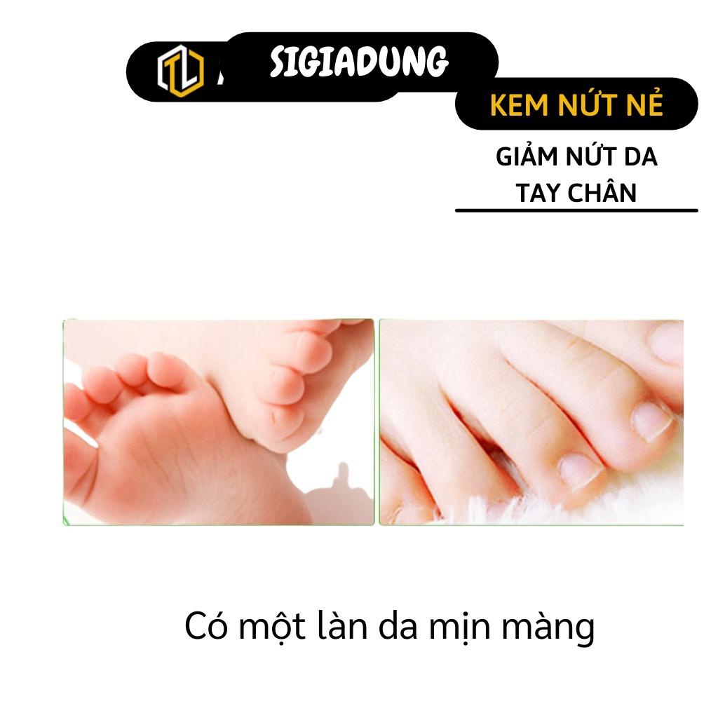 [SGD] Kem Dưỡng Ẩm Chân - Kem Chống Nứt Chân Và Tay Hiệu Con Ngựa Nuôi Dưỡng Và Giữ Ẩm 5523