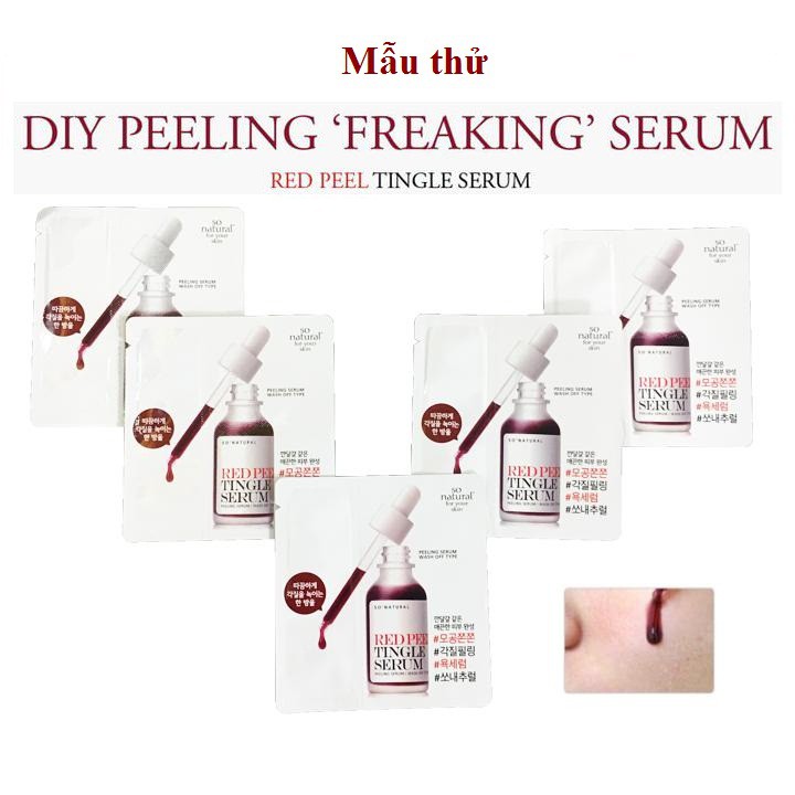 Tinh Chất Tái Tạo Thay Da Sinh Học So Natural Red Peel Tingle Serum