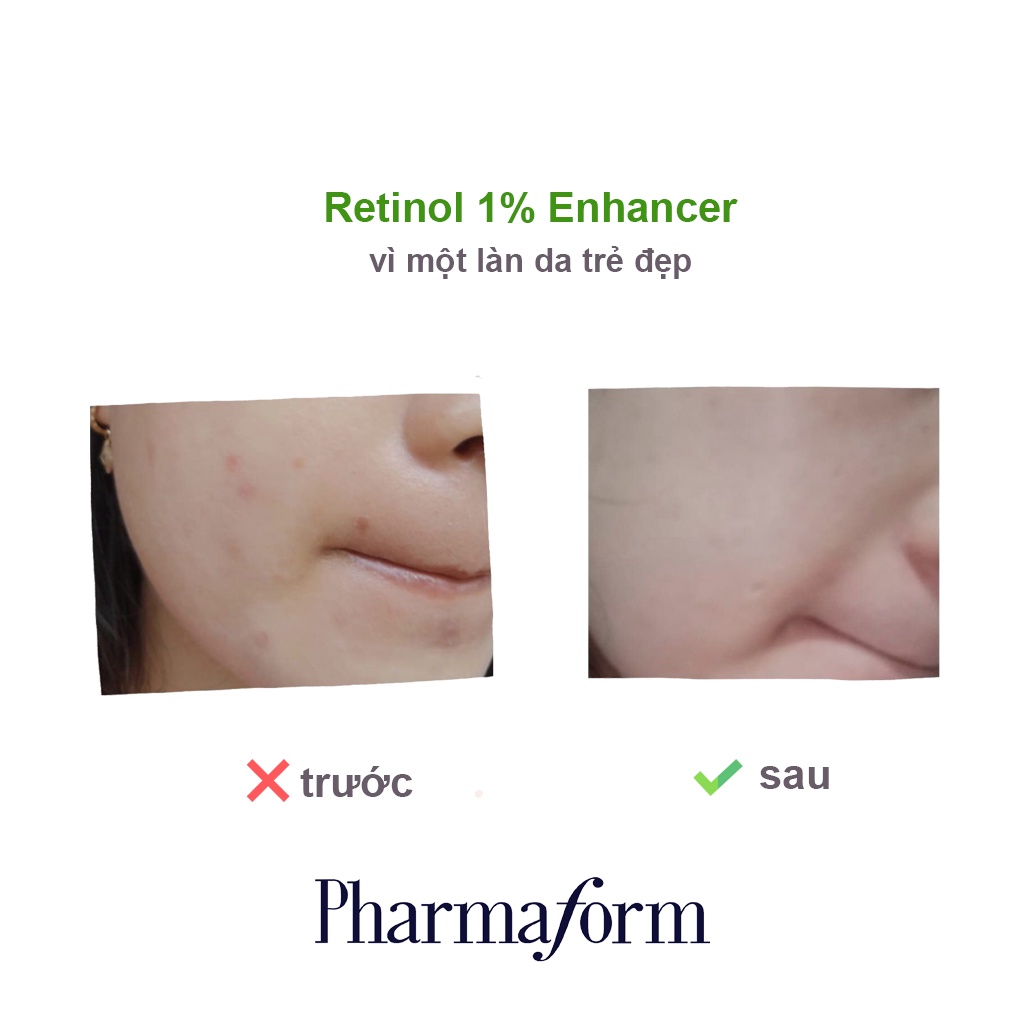 Tinh chất chống lão hóa Pharmaform Retinol Enhancer 1.0 - 20ml