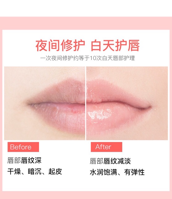 Mặt nạ ủ dưỡng môi LEEZI | BigBuy360 - bigbuy360.vn