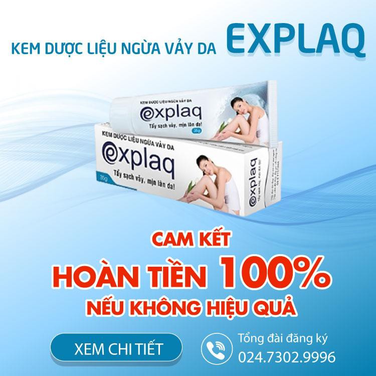 [CHÍNH HÃNG] Kem ngừa vẩy da Explaq hỗ trợ điều trị vảy nến