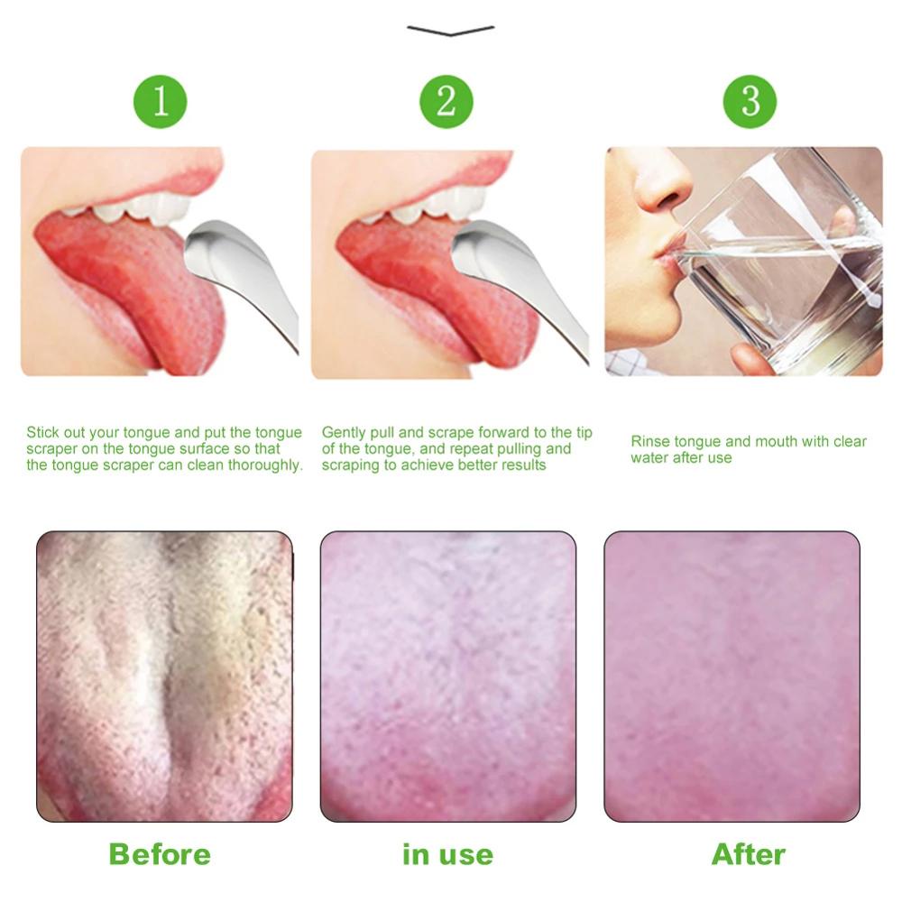 OCEANMAP Dụng Cụ Cạo Lưỡi Bằng Thép Không Gỉ Màu Bạc An Toàn Cho Sức Khỏe Cho Trẻ