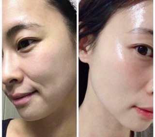 (Tách set)  Serum dưỡng da Eldas EG tox Program