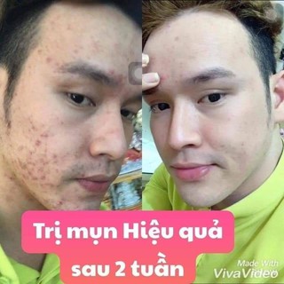 Kem mụn thảo dược hoa đào 2 weeks