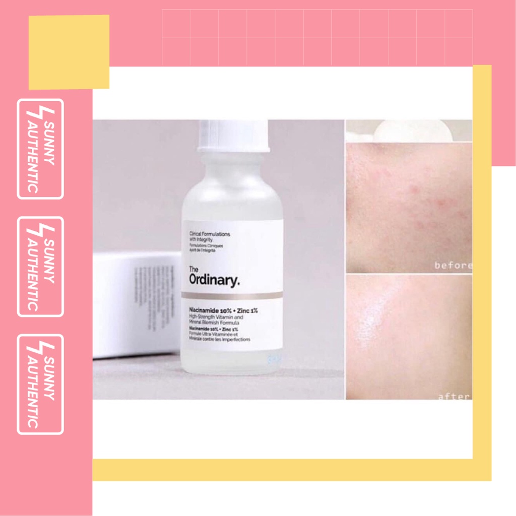 Tinh chất giảm mụn và giảm thâm The Ordinary Niacinamide 10% + Zinc 1%