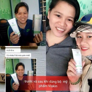 Sữa rửa mặt viskin