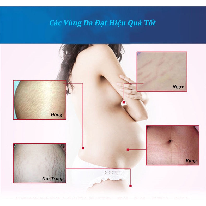 Kem Massage Chống Rạn Da Vùng Bụng Và Chống Nhăn Toàn Thân Phục Hồi Vết Sẹo Mang Thai STRETCH MARKS