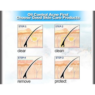 Mask dành cho da mụn của Bioaqua