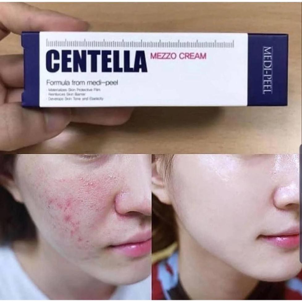 [CHÍNH HÃNG] Kem Giảm Mụn Rau Má Medi-Peel Centella Mezzo Cream - Medi Peel