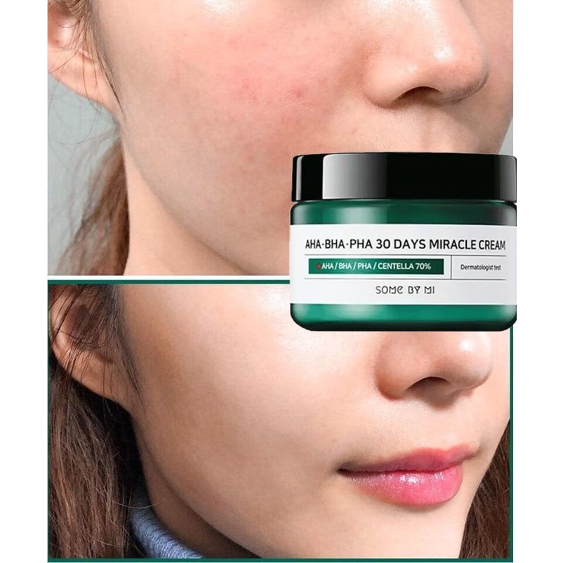 Kem Dưỡng Giảm Và Phục Hồi Da Mụn Some By Mi AHA BHA PHA 30 Days Miracle Cream 60g