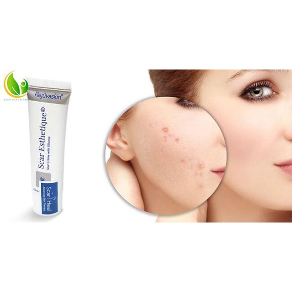 Kem sẹo Scar Esthetique Mỹ chính hãng 10g, mờ sẹo lồi, lõm, sẹo thâm, rỗ, sẹo lâu năm, rạn da...