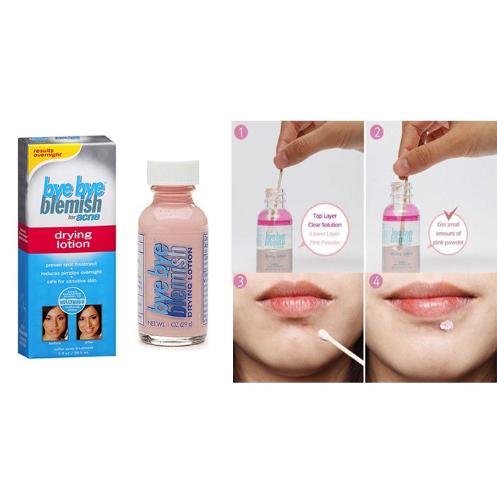 BYE BYE BLEMISH FOR ACNE DRYING LOTION GIẢM MỤN | BigBuy360 - bigbuy360.vn