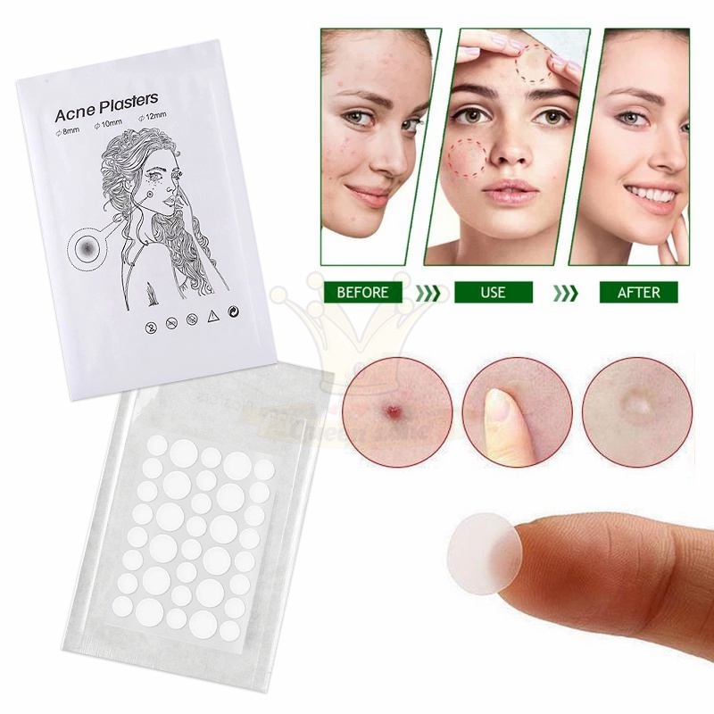 Set 36 Miếng Dán Hỗ Trợ Giảm Mụn Vô Hình Tiện Dụng Miếng Dán Hỗ Trợ Cải Thiện Mụn Kiểm Soát Dầu Không Thấm Nước