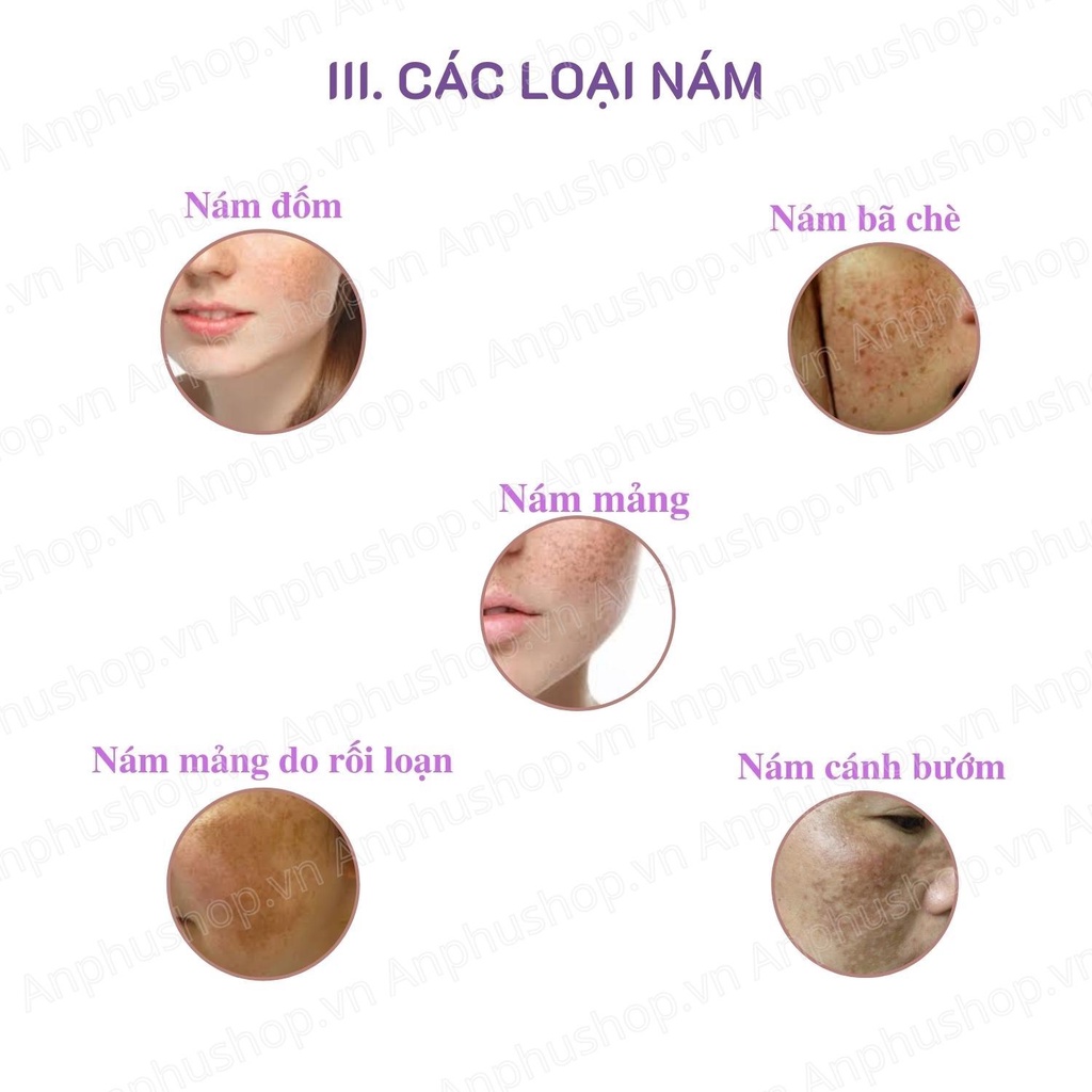 (Hàng chính hãng) Kem nám, tàn nhang Melloderm-HQ 4% Thái Lan