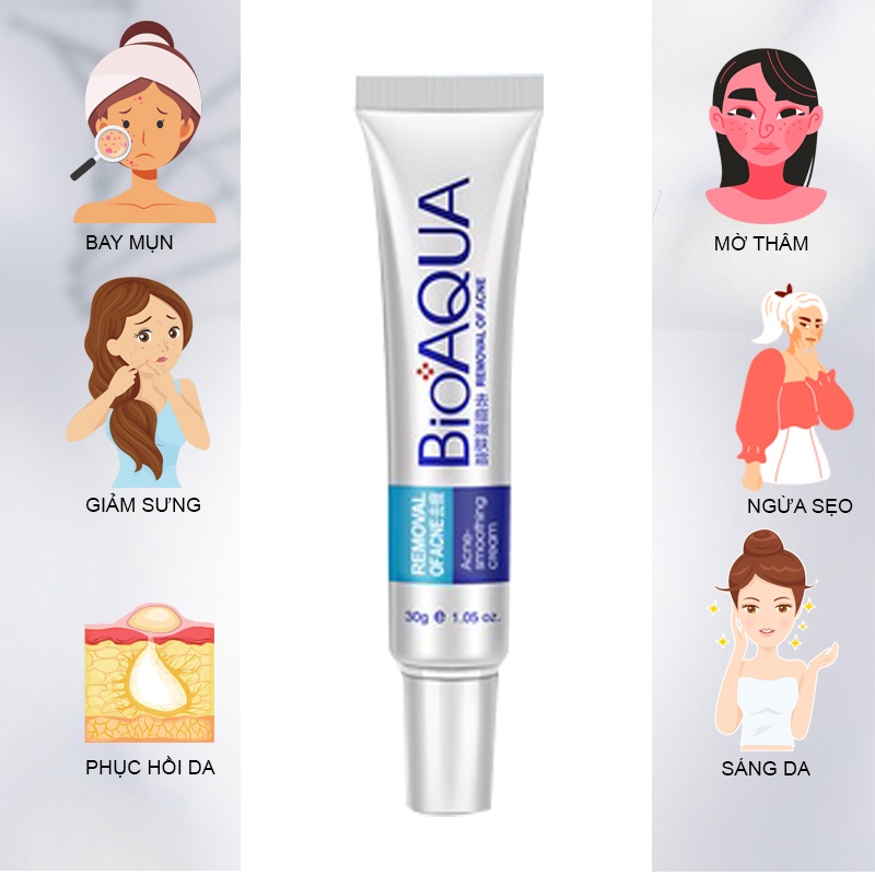 Kem giảm mụn,BIOAQUA, ngừa rạn da,sẹo, thâm,mụn lưng,mau lành vết thương, nam, nữ, tuổi dậy thì 30g hàng chính hãng.