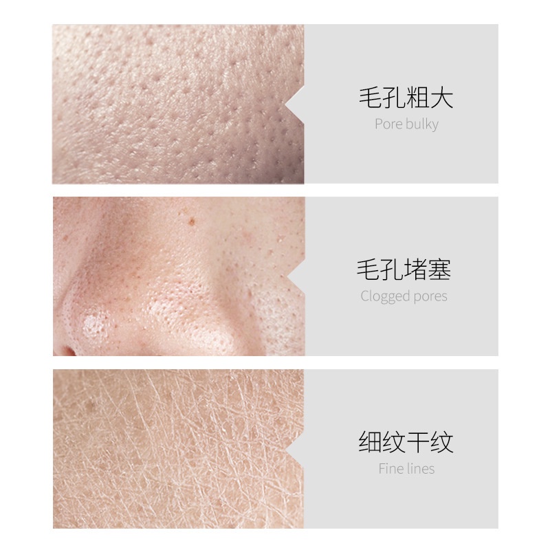 Về Young!Tinh Chất Se Khít Lỗ Chân Lông Làm Sạch Sâu Và Săn Chắc Da