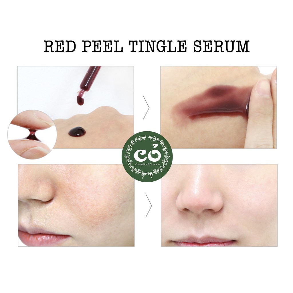 [Mã COS1904 giảm 8% đơn 300K] Peel da không bong tróc Red Peel Tingle Serum | BigBuy360 - bigbuy360.vn