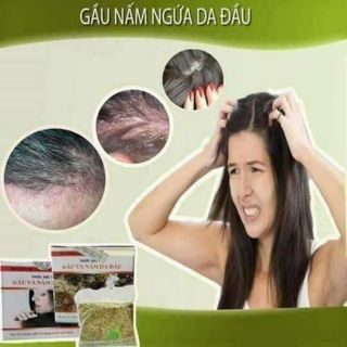 Dầu gội Trần Kim Huyền