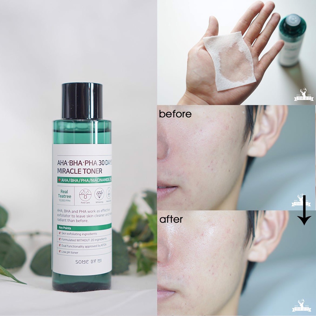 Nước Hoa Hồng Giảm Mụn Some By Mi AHA BHA PHA 30 Days Miracle Toner Some By Mi AHA 150ML - Wincy Mart