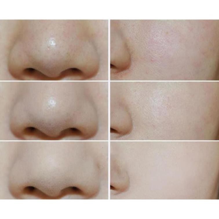 Phấn phủ dạng nén Shiseido Baby Pressed, phấn phủ trang điểm tươi sáng mịn màng | BigBuy360 - bigbuy360.vn