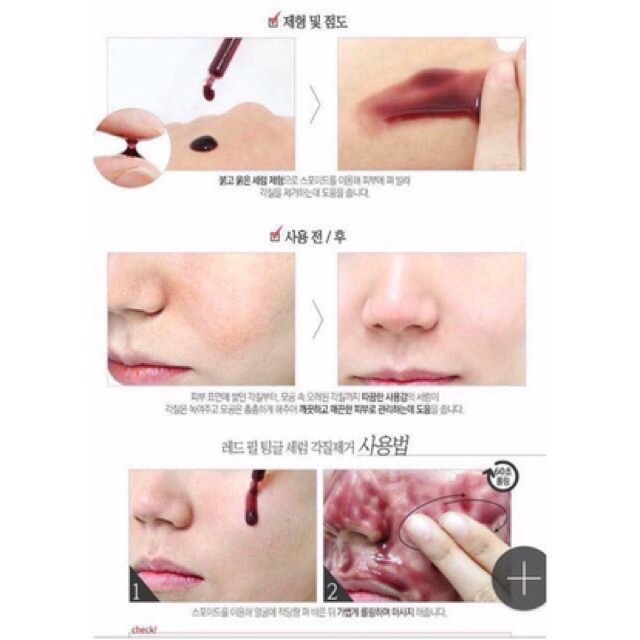 [Mẫu Mới 35ml/20ml] Thần Duợc Tẩy Da Chết Hóa Học Red Peel Tingle Serum | BigBuy360 - bigbuy360.vn