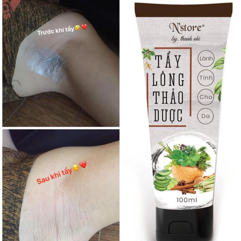 [CHÍNH Hãng] Kem Tẩy Lông Thảo Dược, Kem Tẩy Lông N'Store, Triệt Lông Vĩnh Viễn | BigBuy360 - bigbuy360.vn