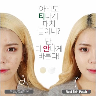 Gel vá da Not4U Real Skin Patch