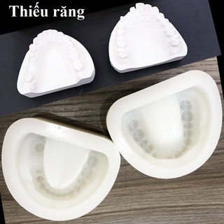 Khuôn đổ mẫu hàm lý tưởng