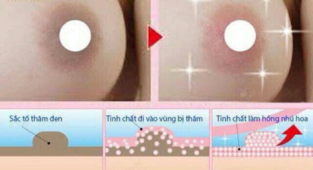 Kem làm hồng nhũ hoa NuWhite N1- cam kết chính hãng hồng chỉ sau 5- 7 ngày