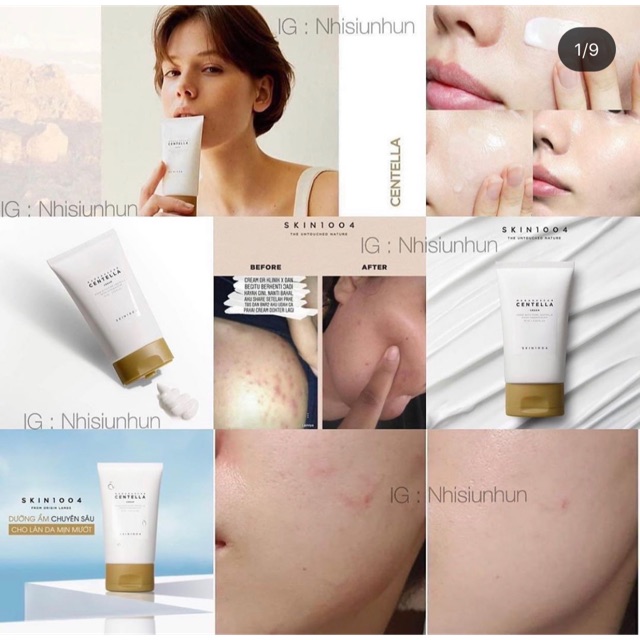 Kem dưỡng Skin1004 Madagascar Centella Cream