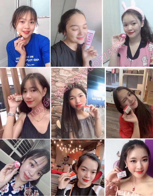 Kem mụn Hoa Đào ThinGroup | BigBuy360 - bigbuy360.vn