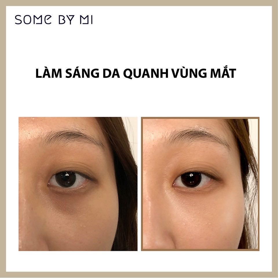 Bộ Dưỡng Sáng da Some By Mi Galactomyces Pure Vitamin C.