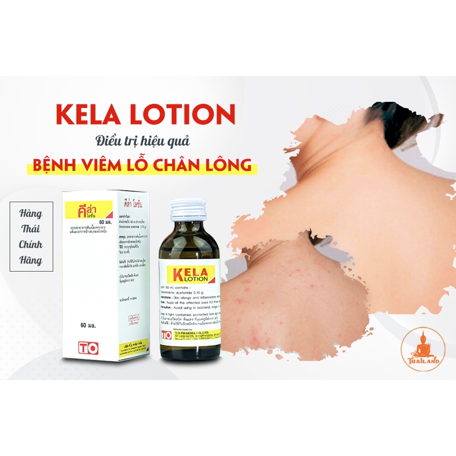 Bill Thái-KELA LOTION DÙNG CHO VIÊM LỖ CHÂN LÔNG 30ml