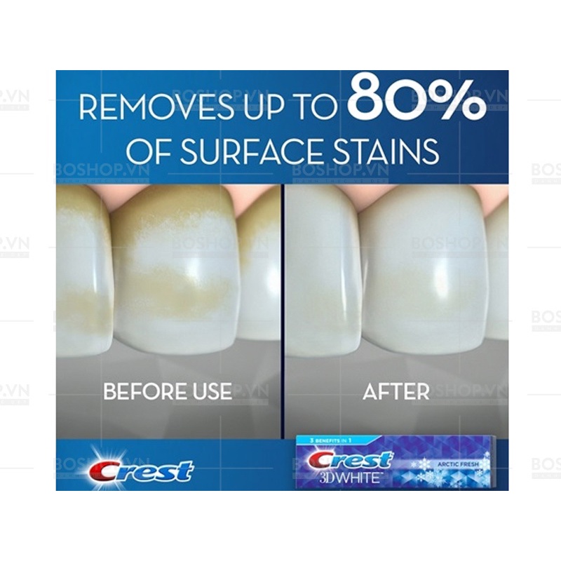 KEM ĐÁNH RĂNG CREST 3D WHITE 80% ARCTIC FRESH 76g