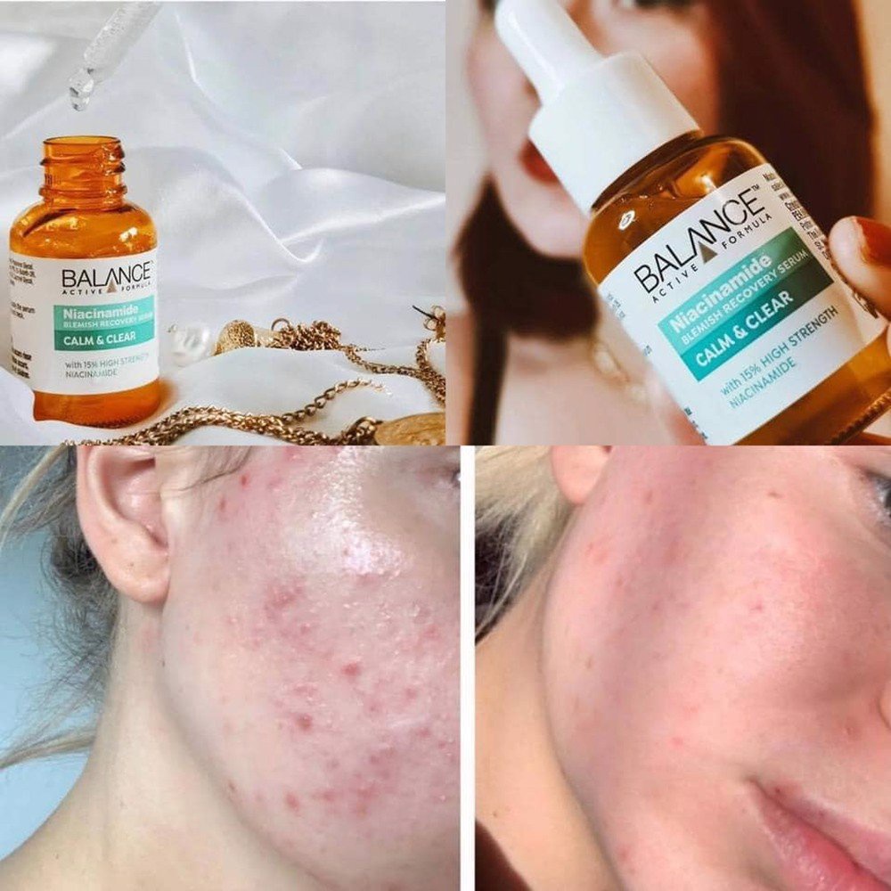 Tinh chất dưỡng trắng da, mờ thâm, dưỡng ẩm Balance Active Formula Serum 30ml (Vitamin C, Niacinamide, Hyaluronic)