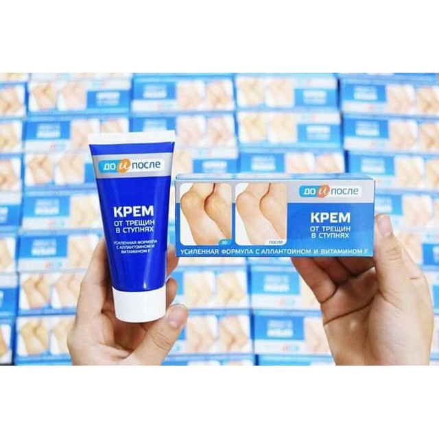 Kem trị nứt gót chân Nga