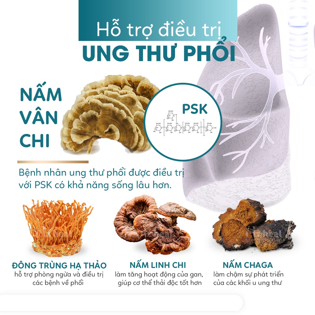 Viên Uống Bổ Phổi Xtend Life Lung Support Plus