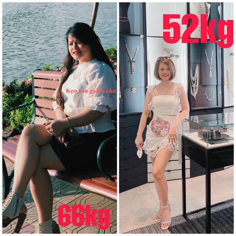 Kẹo Táo Giảm Cân Kaone Slim + Kẹo Pro Siết Eo Giảm Mỡ Bụng Đùi Bắp Tay