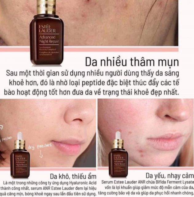 Serum trẻ hóa da Estee Lauder.