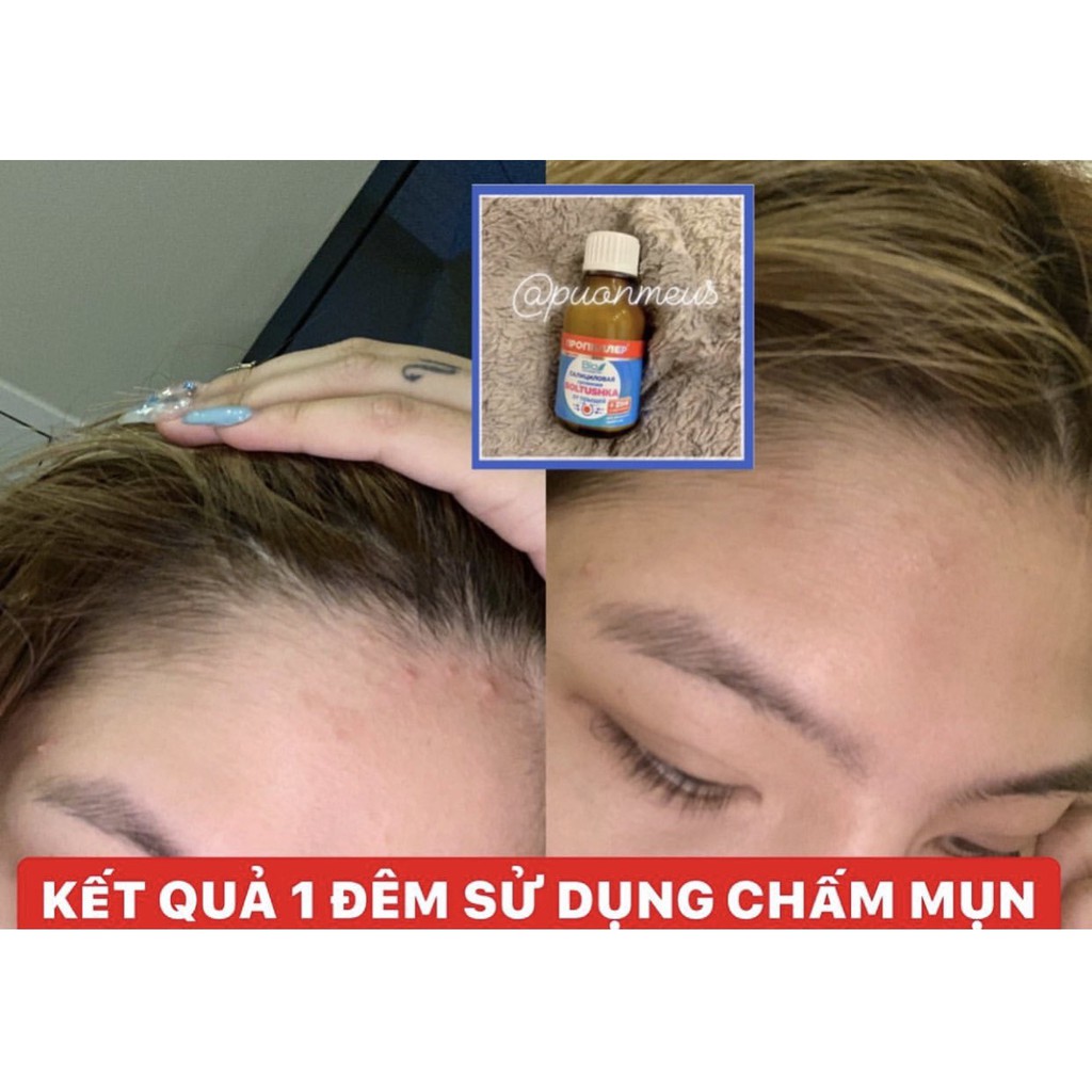 [HÀNG CHÍNH HÃNG] CHẤM MỤN MỜ THÂM bymaomao