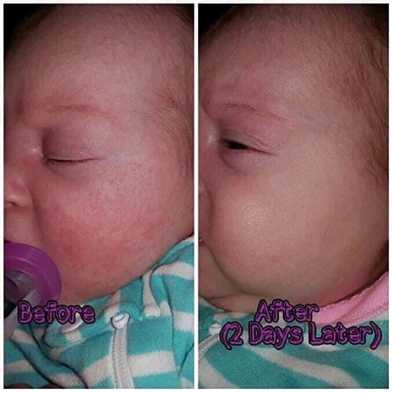 XỊT MEN VI SINH , LỢI KHUẨN CHO BÉ BABYBIOTICS 120ML MẪU MỚI NHẤT  - BAABEELAND