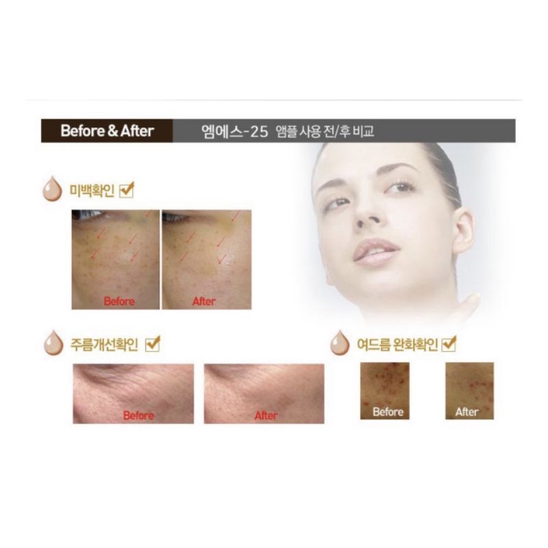 TINH CHẤT SIÊU TRẮNG DA MS25 MIRACLE SOLUTION | BigBuy360 - bigbuy360.vn