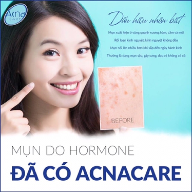 NNO DƯỠNG ẨM ,KHOÁ ẨM CHO DA KHÔ,LÃO HOÁ | BigBuy360 - bigbuy360.vn