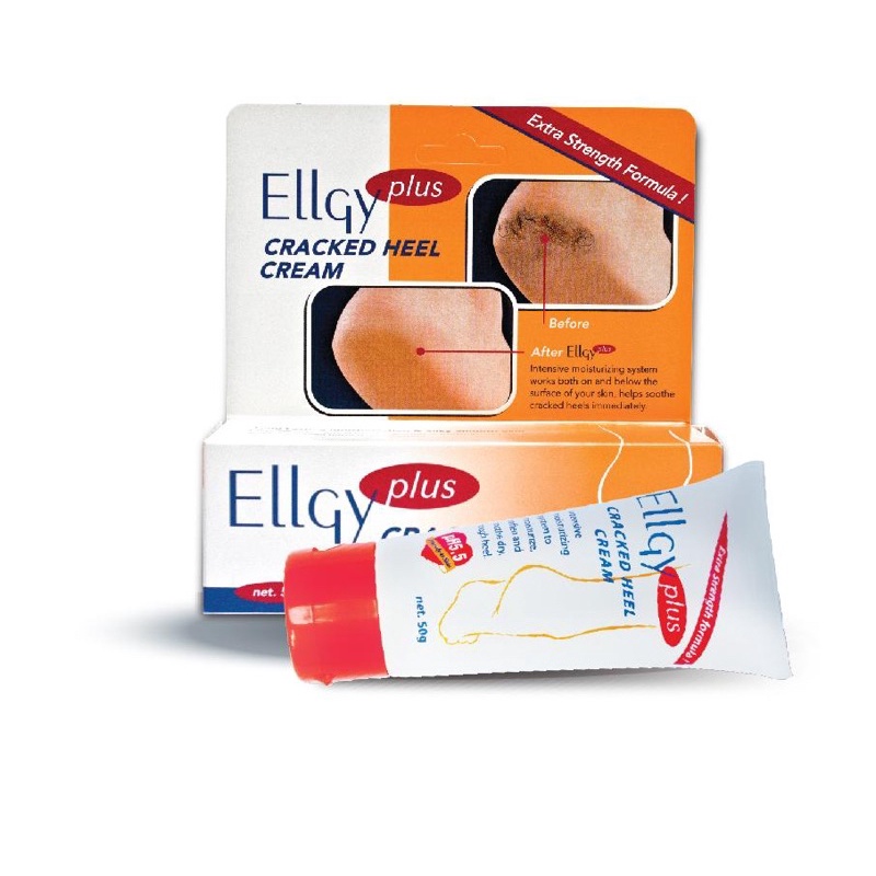 Ellgy plus 25g kem bôi gót chân