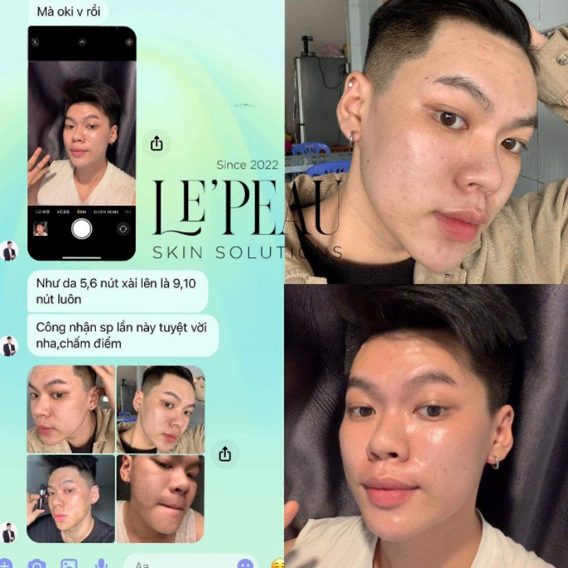 Peed da Vi Tảo Retinol 7 ngày sáng mịn.