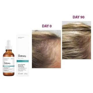 Tinh chất dưỡng The Ordinary Multi peptide dưỡng tóc