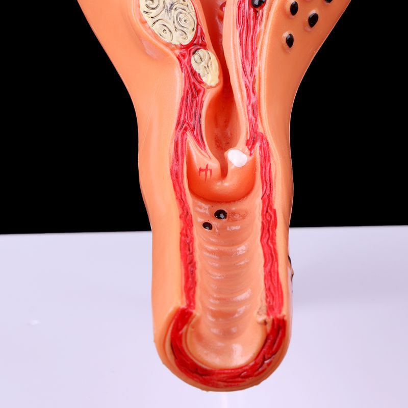 Mô hình giải phẫu cổ tử cung cắt ngang dành cho dạy học
