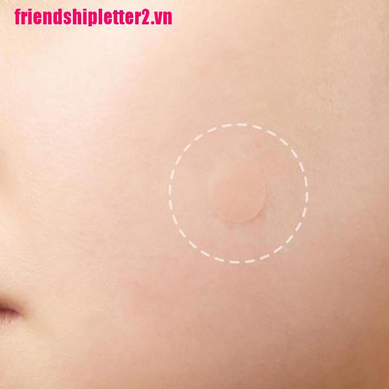 (Hàng Mới Về) Set 36 Miếng Dán Trị Mụn Chăm Sóc Da Hiệu Quả | BigBuy360 - bigbuy360.vn