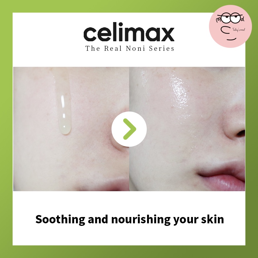 The Real Noni Energy Toner 150ml, Cream 50ml Chăm Sóc Da Mụn Trứng Cá Không Cần Dùng Năng Lượng Thật