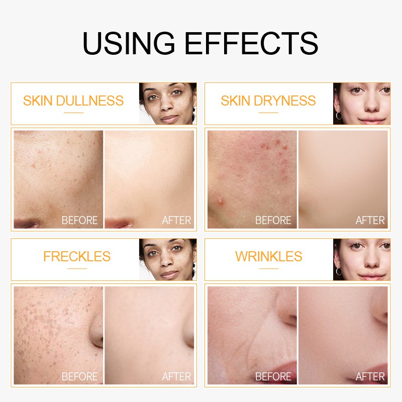 Serum làm trắng da LAIKOU với thành phần vitamin c giúp loại bỏ quầng thâm và chống lão hóa hiệu quả cao cấp 17ml